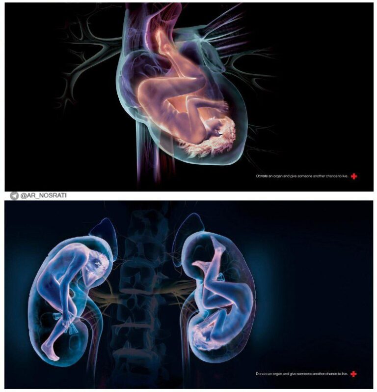 ایده تبلیغاتی اهدای عضو در چین