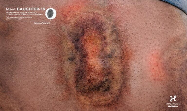 ایده تبلیغاتی خشونت خانگی علیه زنان